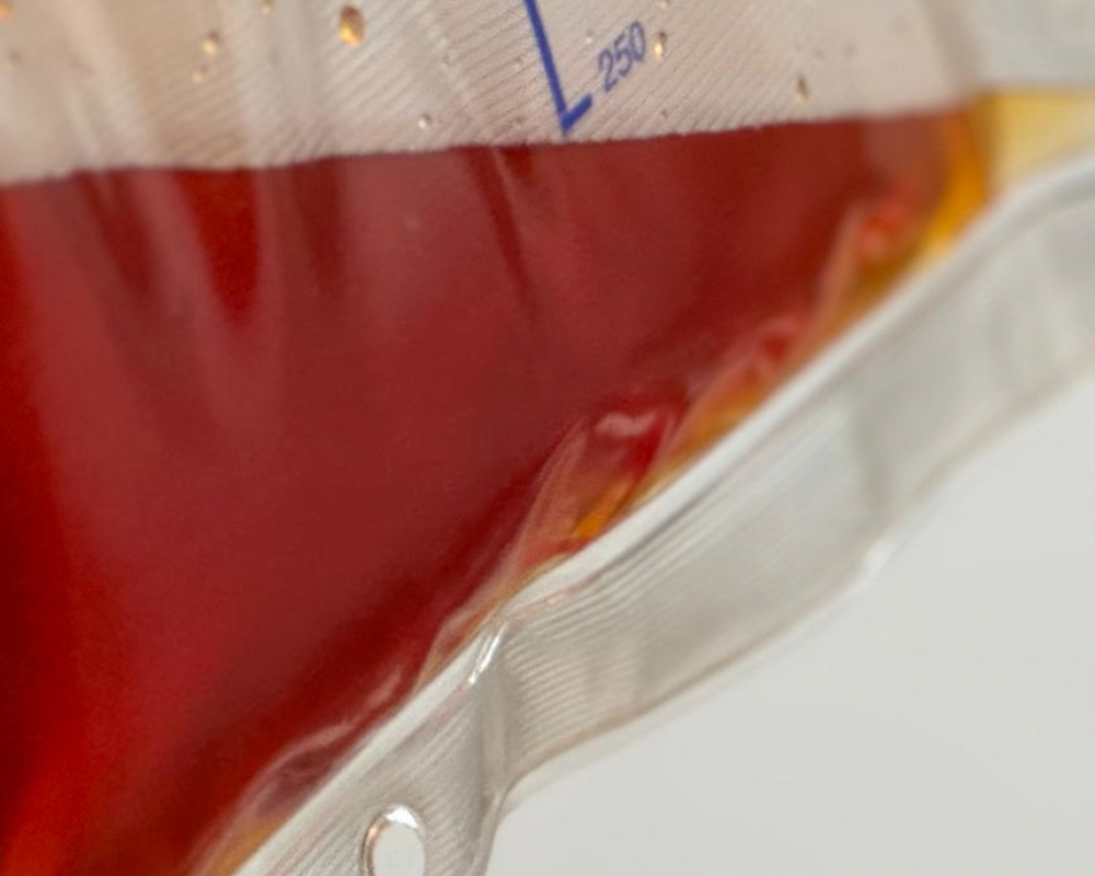 vitasangius_blutreinigung_blutwaesche_apherese_longevity_reinheit